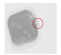 画像：噛み込み検査